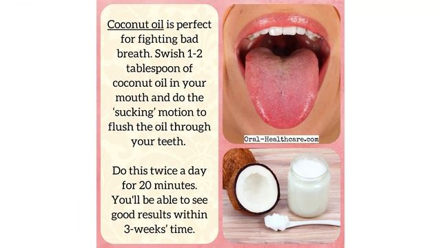 Free Dental Care - 27 Home Dental Care Tips смотреть онлайн
