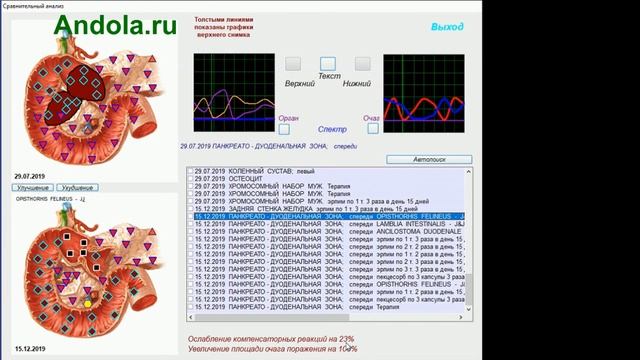 Для чего нужны и как работают приборы Биотест и Биоскан
