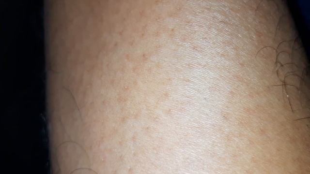 Philips  BRE 245 Epilator  5 Minute Heating Test #epilator #hairremoval