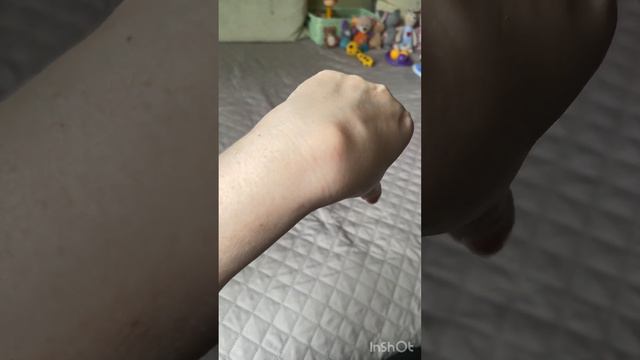 Обнаружила шишку на руке 😕 Гигрома смотреть онлайн