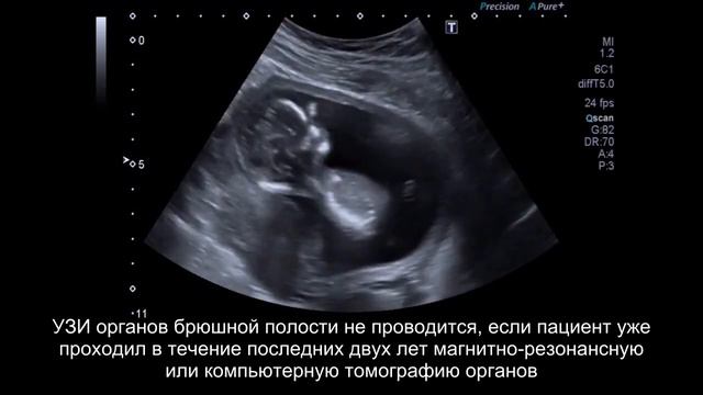 Исследований при диспансеризации станет меньше, сдавать мочу и вовсе не понадобится