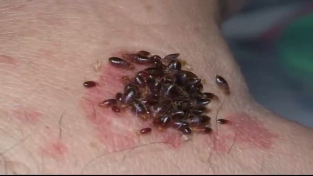 Cuidado con las chinches en la cama | Noticias de Salud смотреть онлайн
