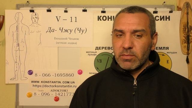 ФОТОФОБИЯ. Акупунктура в помощь. смотреть онлайн