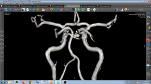 ЧТО ТАКОЕ - ВИЛЛИЗИЕВ КРУГ ? КАК ОН РАБОТАЕТ НА САМОМ ДЕЛЕ .