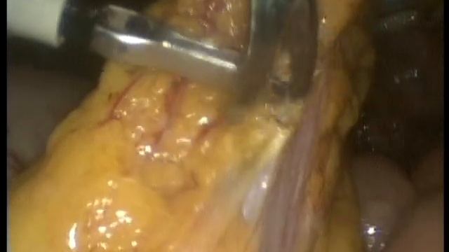 Пограничные опухоли