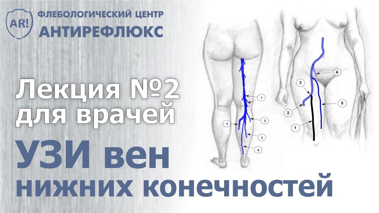 УЗИ вен лекция 2. Схема ультразвукового сканирования вен смотреть онлайн