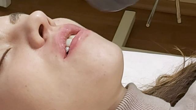 АирисКом студенты учатся: практическое занятие по  увеличению объема губ.