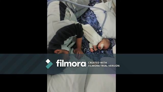 Our Beautiful memories of River Pitman- 3months old with trisomy 18 смотреть онлайн