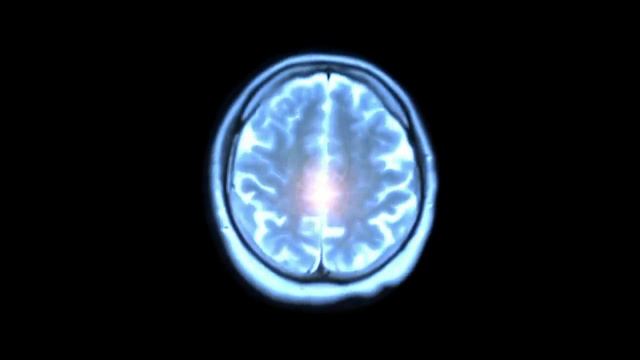 Шишковидная железа один из основных органов управления жизнью человека смотреть онлайн