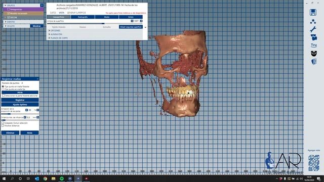 DICOM VIEWER en exocad смотреть онлайн