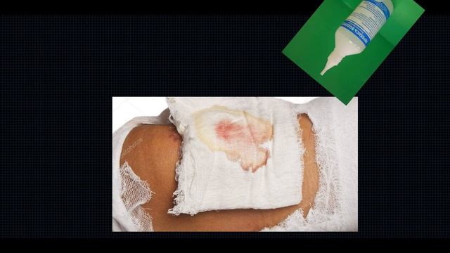 ПЕРЕВЯЗКА РАНЫ В ДОМАШНИХ УСЛОВИЯХ смотреть онлайн