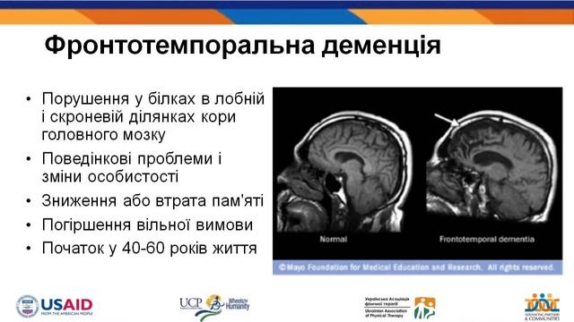 Demention смотреть онлайн