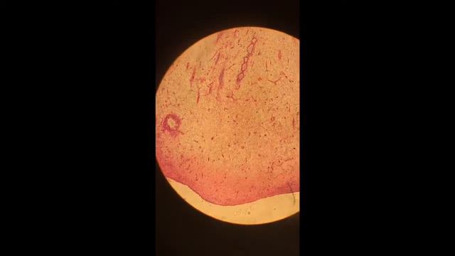 PATHOLOGY 2 || Microscope slides || 10 смотреть онлайн