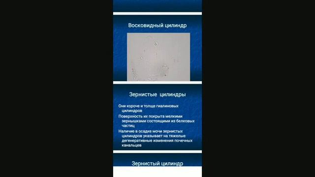 qon hujayralari mikroskopiyasi peshob ( siydik )dagi patologik hujayralar смотреть онлайн
