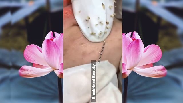 Удивительная процедура для лица для сияющего ухода за кожей и красивым лицом # 12 смотреть онлайн