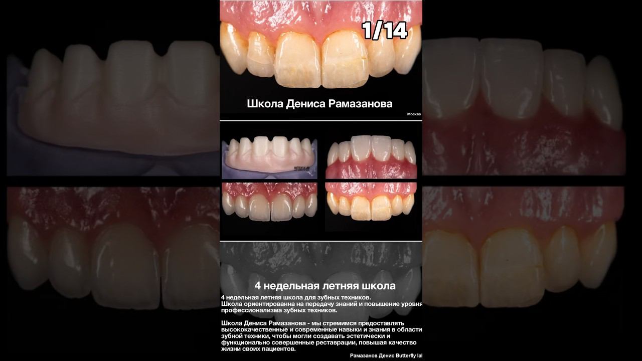 4 недельный курс для зубных техников. Все детали в прикрепленному видео #зубнойтехникмосква #cadcam смотреть онлайн