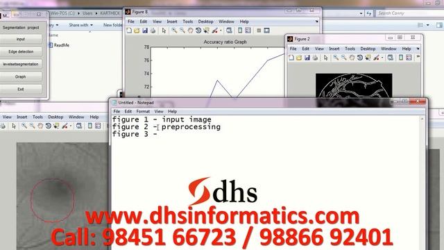 DHS MATLAB Projects An Enhanced Edge Detection Algorithm Distributed Canny Edge Method смотреть онлайн