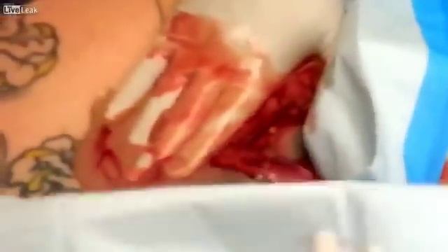 Воспаление татуировки смотреть онлайн