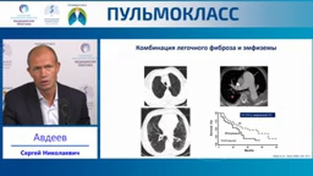 ПУЛЬМОКЛАСС смотреть онлайн