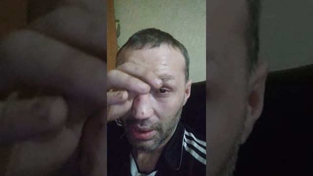 Видео Камеры В Глазах 119 Нету Помощи Не Какой смотреть онлайн
