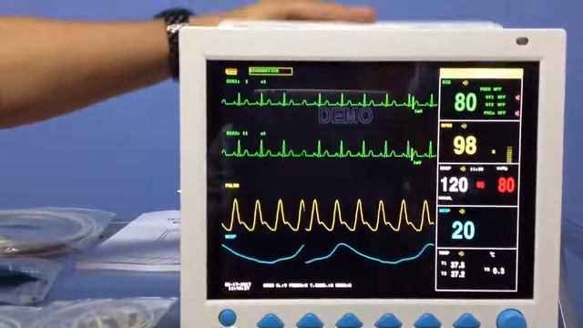 MONITOR MULTIPARAMETRO PARA USO VETERINARIO смотреть онлайн