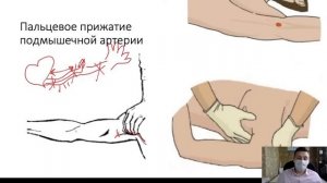 Первая помощь при кровотечениях (основы)