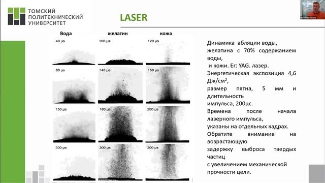 "ФИЗИКА ЛАЗЕРА ДЛЯ ВРАЧА" часть 3 смотреть онлайн