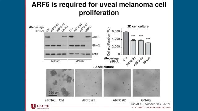 A Potential Molecular Target for the Treatment of Uveal Melanoma смотреть онлайн