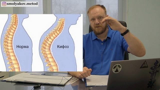 Что значит КИФОЗ (медицинские термины простыми словами) смотреть онлайн
