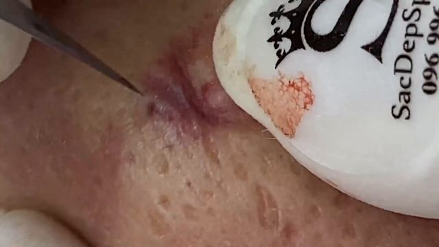 Relax Every Day With Sac Dep Spa #0074 смотреть онлайн