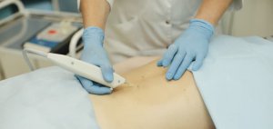 Карбокситерапия