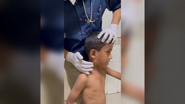 CERVICAL LYMPHNODES EXAMINATION смотреть онлайн
