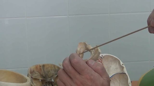 Затылочная кость 1 смотреть онлайн