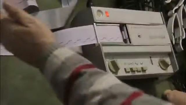 Кардиограмма сердца лягушки смотреть онлайн