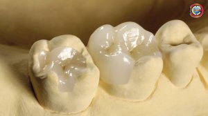 Эстетические вкладки Д А  Воробьев