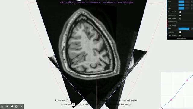 MRI curve tool with WebGL смотреть онлайн