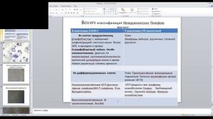 Лимфопролиферативные заболевания  Хронический лимфолейкоз Ходжкинская и неходжкинские лимфомы