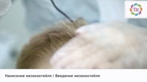 Фракционная мезотерапия кожи головы | Процедура Роял Медик