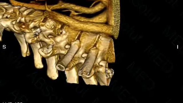 Brahiocefal Anomal 1861 new смотреть онлайн