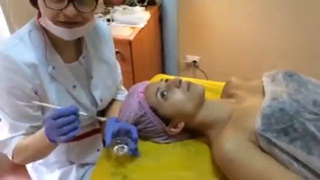 ЧИСТКА ЛИЦА + ПИЛИНГ (всесезонный)!!!!! -1 этап смотреть онлайн