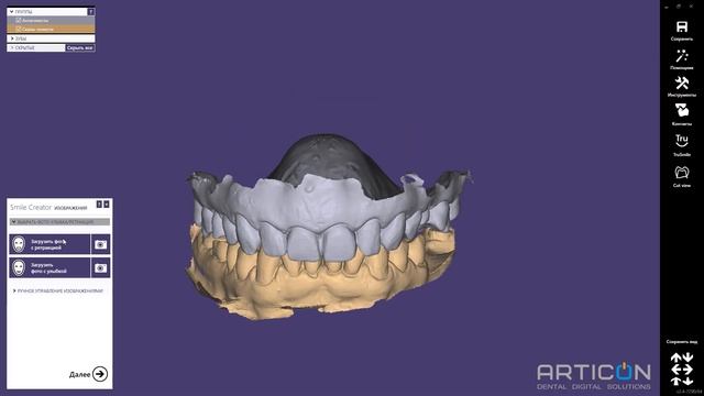 Применение нейросети, улучшающей качество фотографии для Exocad Smile Design смотреть онлайн