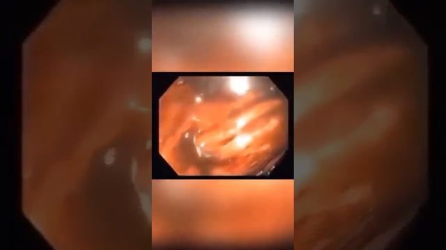 GreenMax компании M-International решит проблемы кишечника