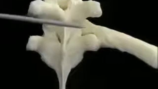 Грудная клетка - Анатомия просто! смотреть онлайн