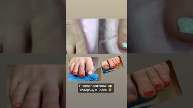 А сколько вы носите педикюр? смотреть онлайн