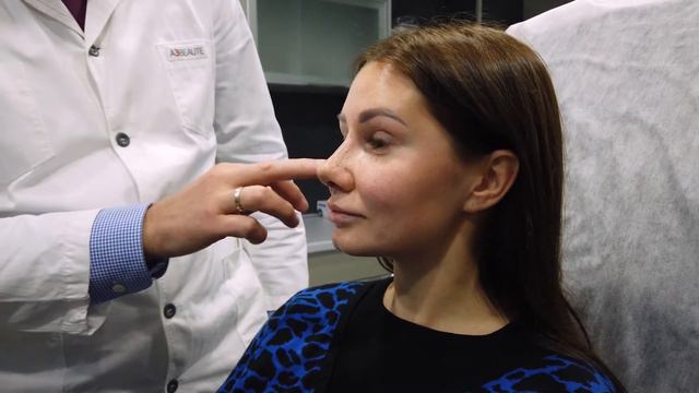 Пьезо ринопластика Кати — снятие лангеты — Виталий Жолтиков смотреть онлайн