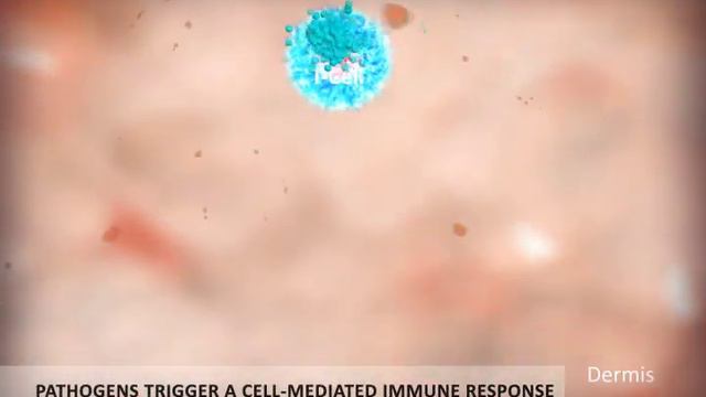 Probiotic Skin Renewal Technology - Mechanism of Action смотреть онлайн