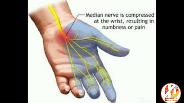 Group study (Ranunculaceae family) of homeopathic materia medica смотреть онлайн