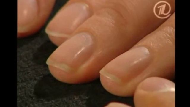 Белые пятна на ногтях, как избавиться смотреть онлайн