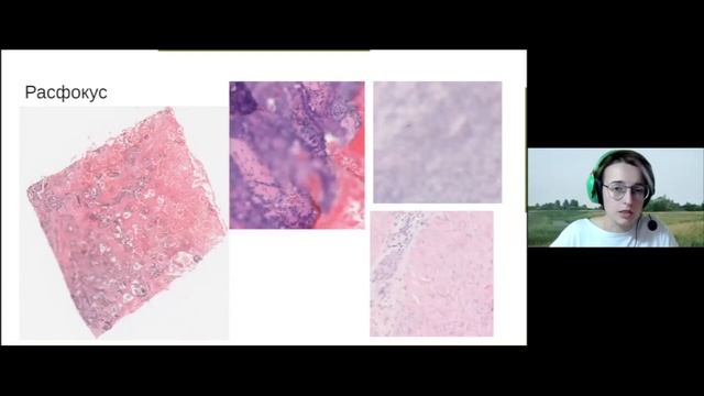 Вероника Семенова - Обзор артефактов на гистопатологических изображениях смотреть онлайн