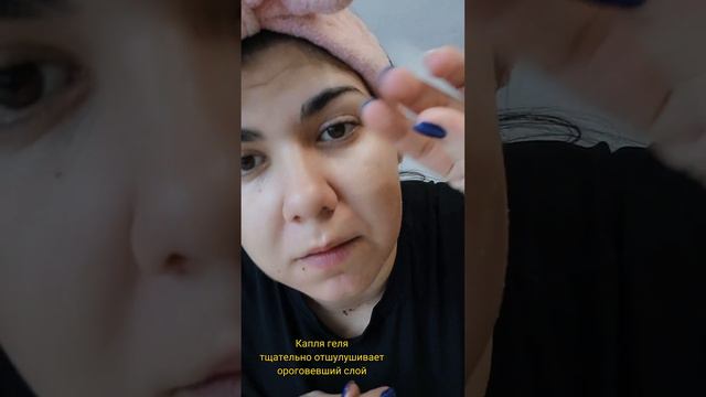 Прыщи?! Черные точки?!Делай так 2 раза в неделю и лицо будет чистым👌Атоми спасает🩵#atomykorea #atom смотреть онлайн